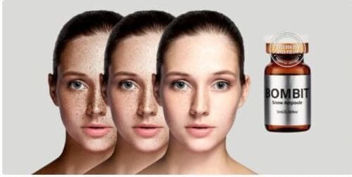 bombit-snow-ampoule-mesotherapy-gia-bao-nhieu-mua-o-dau-uy-tin2