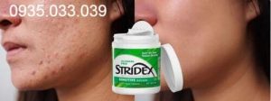 mieng-pad-stridex-tri-mun-gia-bao-nhieu-mua-o-dau-uy-tin2