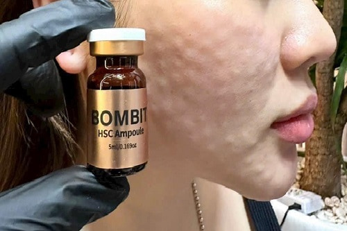 Tinh chất serum Bombit HSC Ampoule công dụng và cách dùng?-1